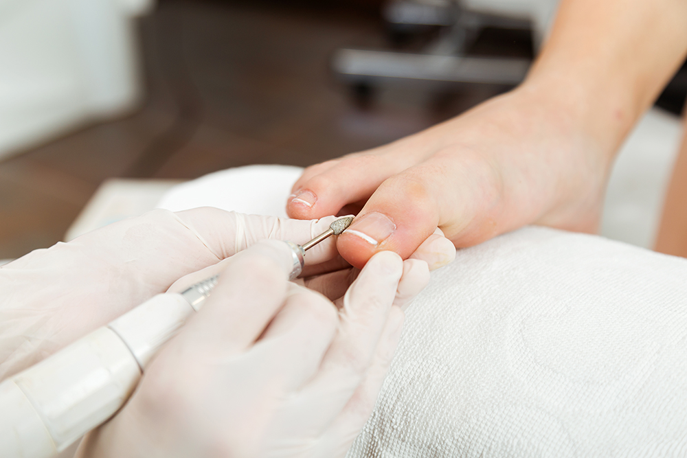 Ongle incarné